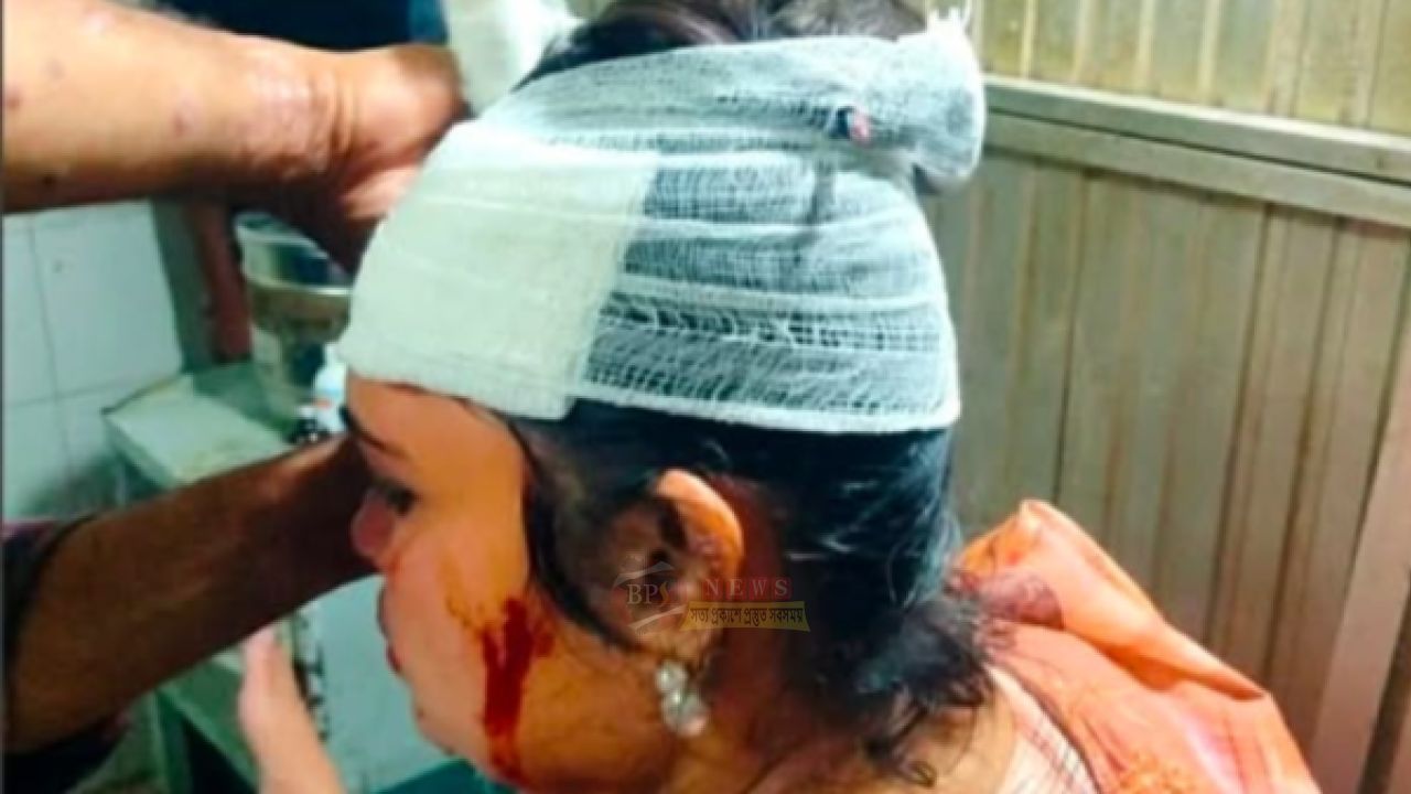 লিংক রোডে বাউল শিল্পীকে পিটিয়ে-ছুরিকাঘাতে ছিনতাই