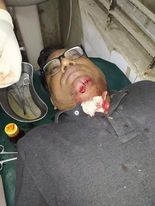 নারায়নগঞ্জে আইনশৃঙ্খলার চরম অবনতি ছিনতাইকারী কবলে এডঃ মামুন