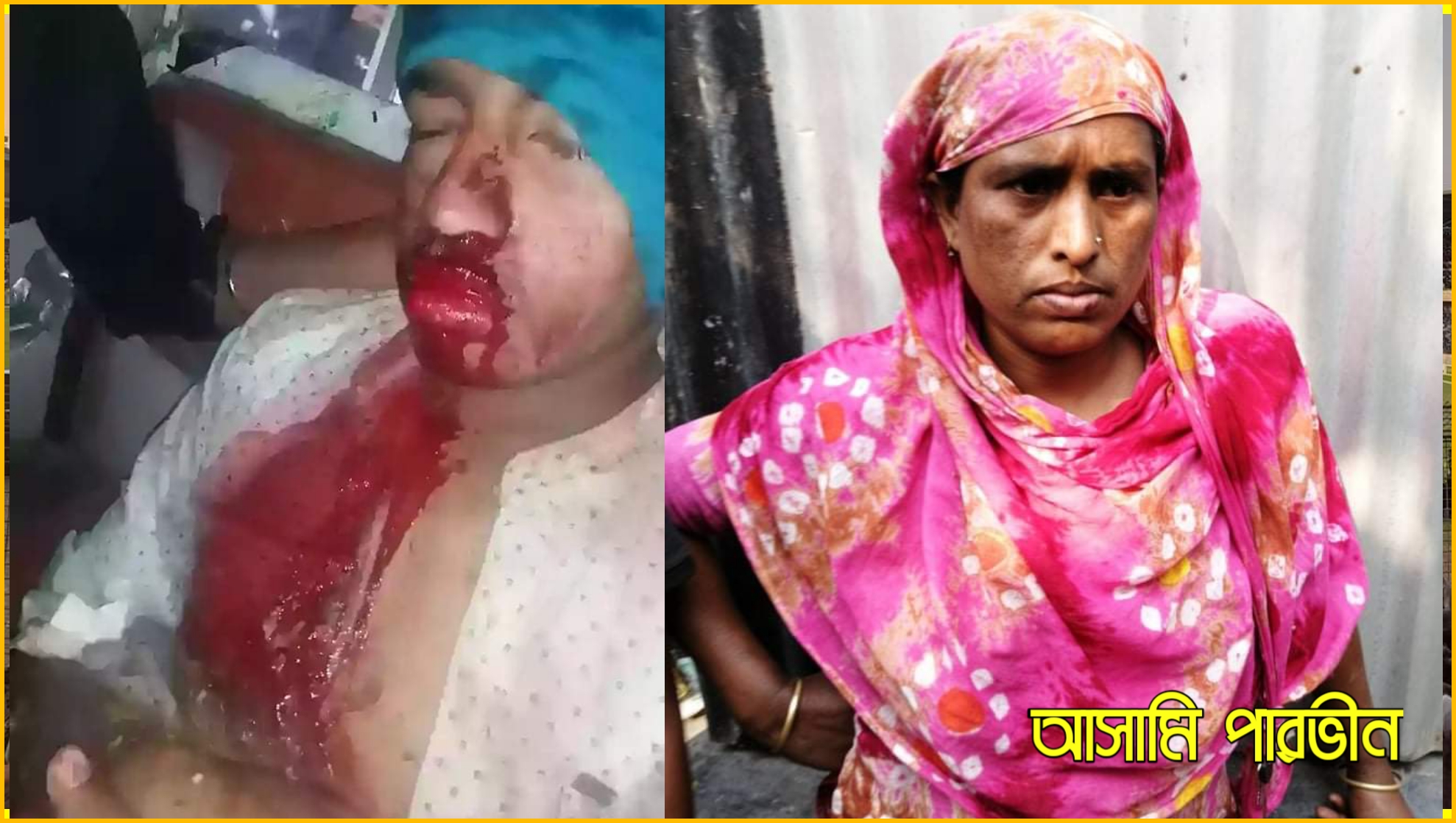 আলীরটেকে মহিলার হাতে চাইনিজ কুড়ালের আঘাতে কিশোরের মৃত্যু