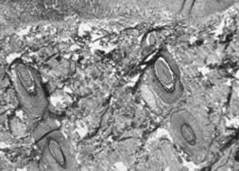 ১২টি দেশে প্রাদুর্ভাব দেখা গেছে মাঙ্কিপক্সের