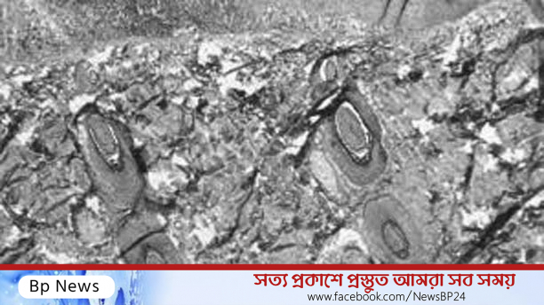 ১২টি দেশে প্রাদুর্ভাব দেখা গেছে মাঙ্কিপক্সের